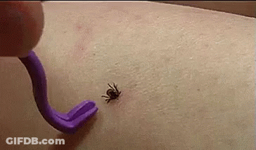 Purple Tick Removal Tool Removing Tick GIF