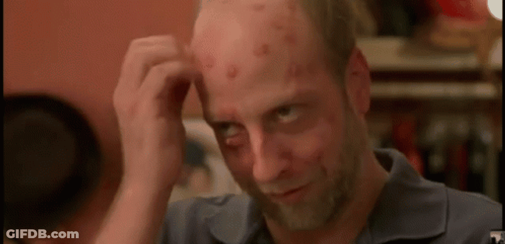 Scab Guy Itchy Head GIF