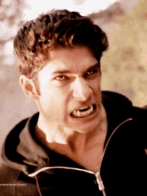 Scott McCall Teen Wolf Angry And Growling GIF