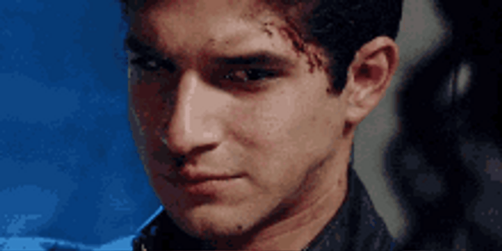 Scott McCall Teen Wolf Worried Look GIF