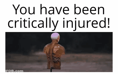Skeleton Saying You Have Been Critically Injured GIF
