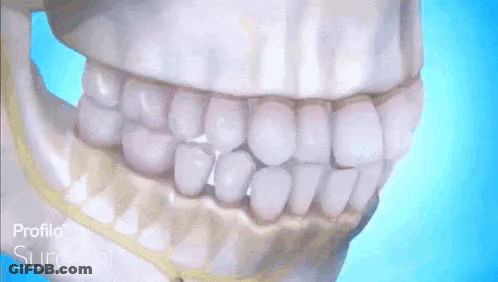 Skull With Braces Saying Surgical GIF