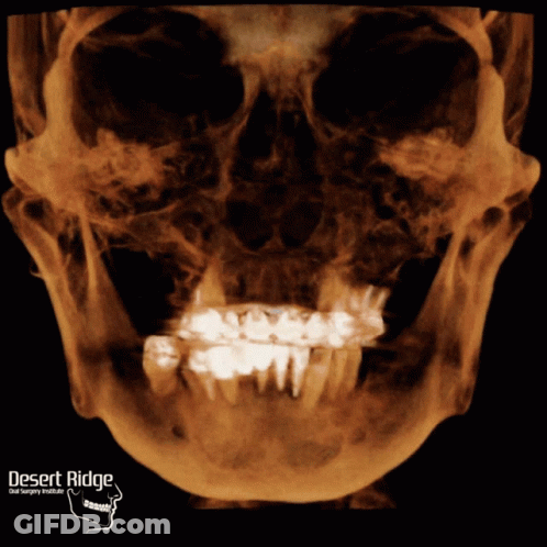 Skull X-Ray Desert Ridge Dental GIF