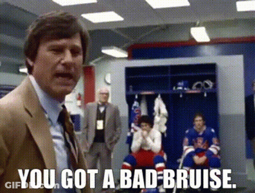 Suit Man Saying You Got Bad Bruise Hockey GIF