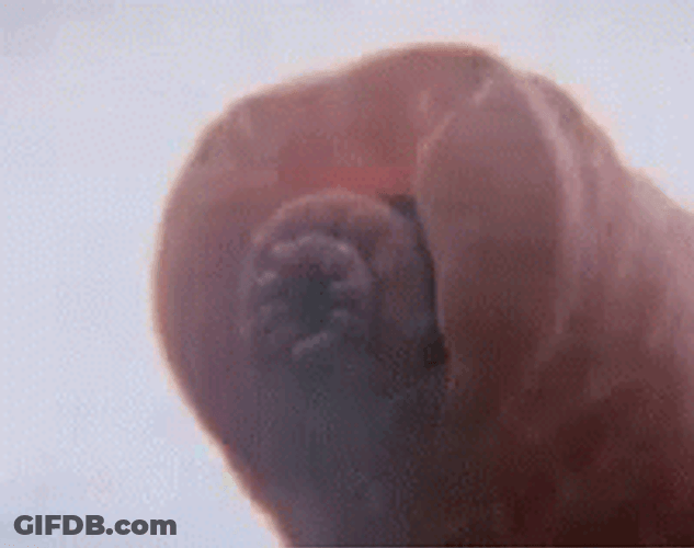 Tardigrade Type Of Leech GIF