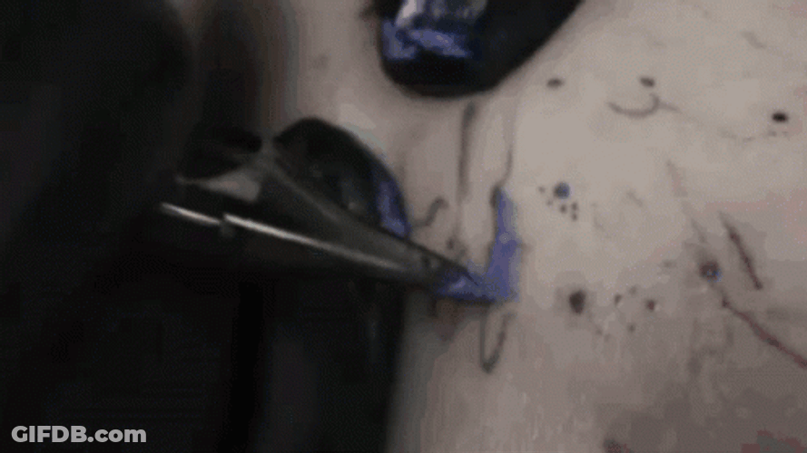 Tattoo Needle Poking The Skin GIF