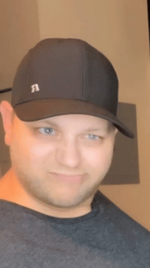 Teeth Out Silly Face GIF