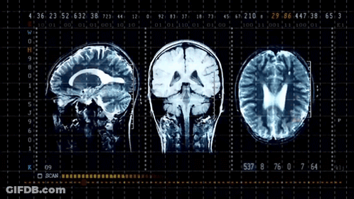 Three Human Brains On Monitor GIF