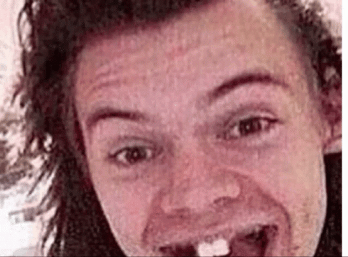 Ugly Harry Styles Predebut Pics GIF
