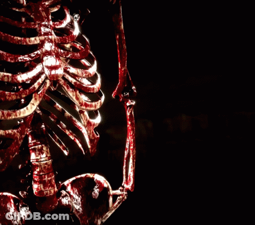 W Flawless Victory Skeleton Poster GIF