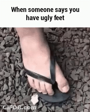 When Someone Says You Have Ugly Feet , A Person Is Wearing A Flip Flop . GIF