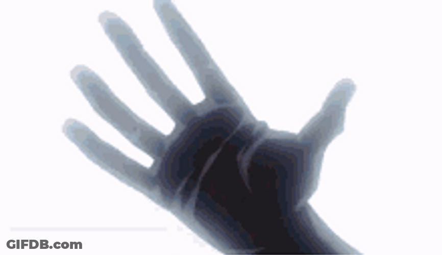 Whitebeard Fight Scenes One Piece Anime GIF