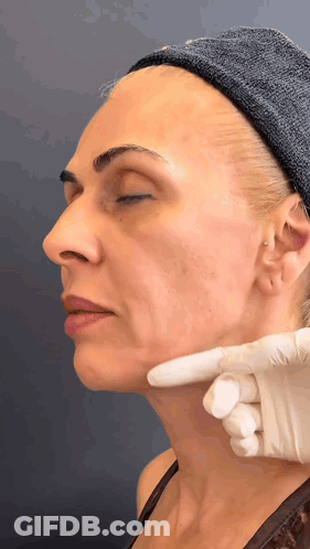 Woman Eyes Closed Examined By Gloved Hand GIF