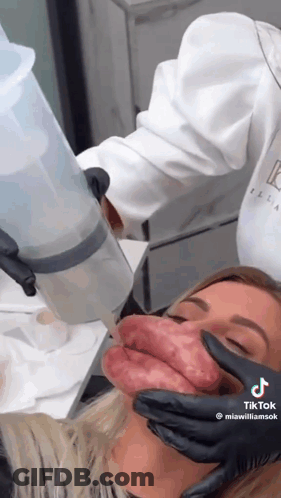 Woman Getting Botox Treatment GIF