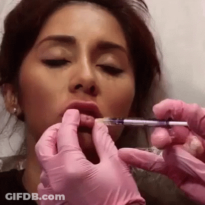 Woman Getting Lip Injection With Pink Gloves GIF