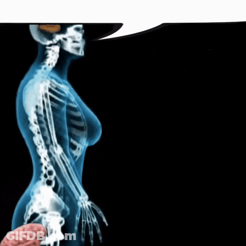 Woman Skeleton X-Ray With Speech Bubble GIF