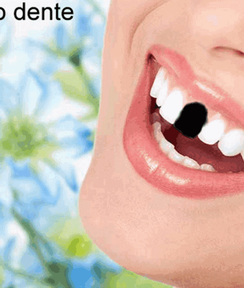 Woman Wide Smile With Missing Teeth Moving GIF