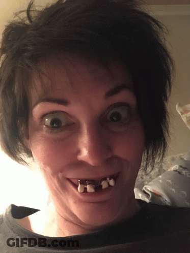 Woman With Braces Smiling GIF