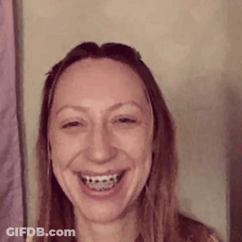 Woman With Braces Smiling GIF