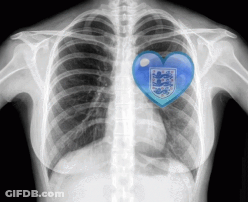 X-Ray Chest Blue Heart England Crest GIF