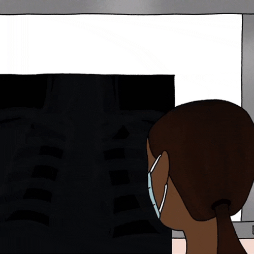 X-Ray Film Scan Lungs GIF