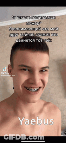 Young Man With Braces And Yaebus On Phone GIF