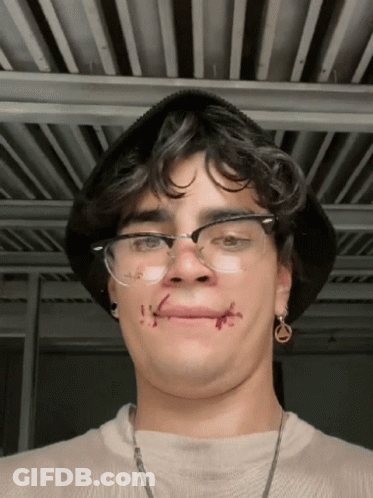 Young Man With Glasses And Stitches GIF