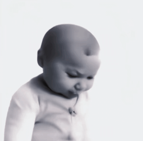 Baby With Bump On Head Looking Down GIF
