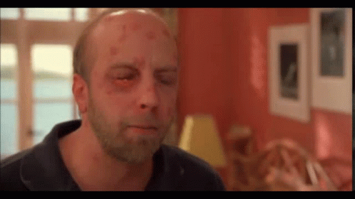 A Bald Man With A Beard And A Black Eye GIF