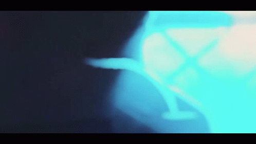 A Blue X-Ray Of A Person 'S Leg GIF
