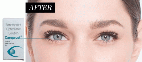 A Box Of Bimatoprost Ophthalmic Solution Next To A Woman 'S Eye GIF