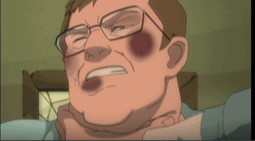 a cartoon of a man with glasses and a black eye