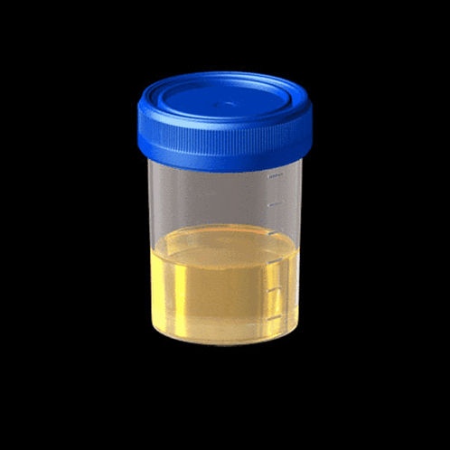 A Clear Container With A Blue Lid Filled With Urine GIF