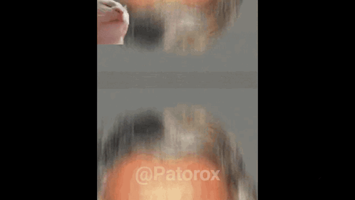 A Close Up Of A Man 'S Face With A Cat 'S Head On His Forehead . GIF