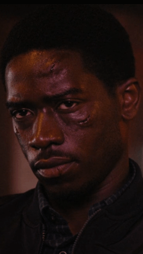 A Close Up Of A Man 'S Face With A Few Spots On It GIF