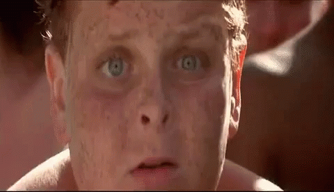 A Close Up Of A Man 'S Face With A Lot Of Freckles On It . GIF