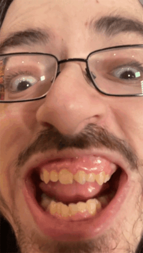 A Close Up Of A Man 'S Face With Glasses And A Mustache GIF
