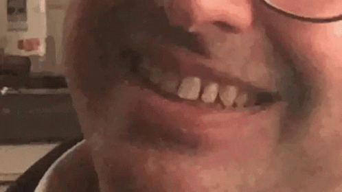 A Close Up Of A Man 'S Mouth With Glasses And A Missing Tooth . GIF