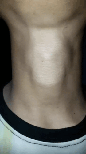 A Close Up Of A Man 'S Neck With A Black Collar GIF