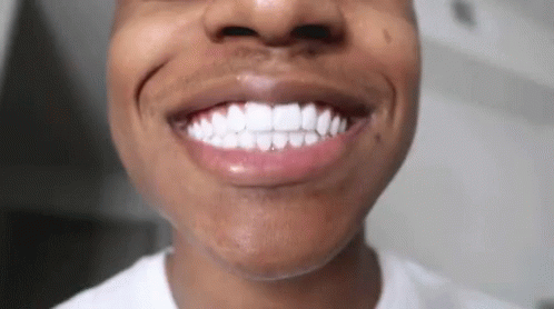 A Close Up Of A Man 'S Teeth With A White Shirt On GIF