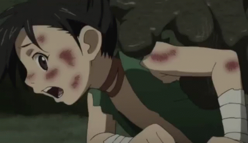 A Close Up Of A Person 'S Face With A Scar On It And A Mouth Open . GIF