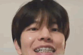 a close up of a person 's face with braces on his teeth .