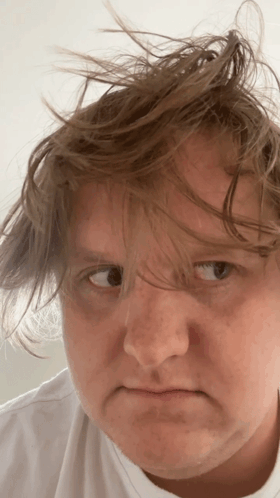 A Close Up Of A Person 'S Face With Messy Hair GIF
