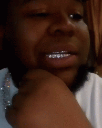 A Close Up Of A Person 'S Mouth With Braces On Their Teeth GIF
