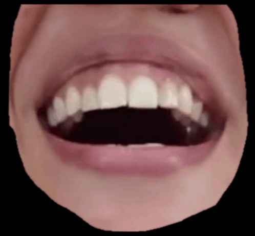 A Close Up Of A Person 'S Mouth With Their Teeth Showing GIF