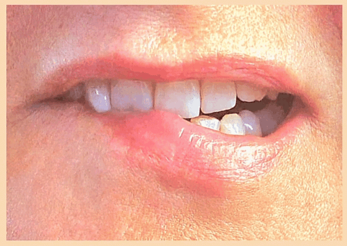 A Close Up Of A Person 'S Mouth With White Teeth And A Red Lip GIF