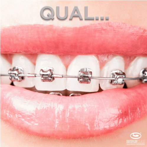 A Close Up Of A Person 'S Teeth With Braces And The Words Qual On The Bottom GIF