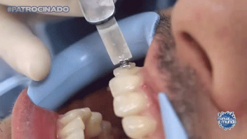 a close up of a person 's teeth with the words #patrocinado on the bottom right