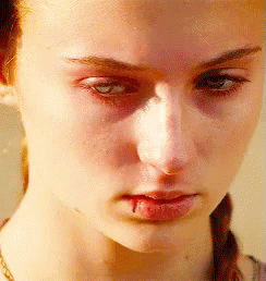 A Close Up Of A Woman 'S Face With Blood Coming Out Of Her Mouth . GIF