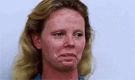 A Close Up Of A Woman 'S Face With Red Freckles . GIF